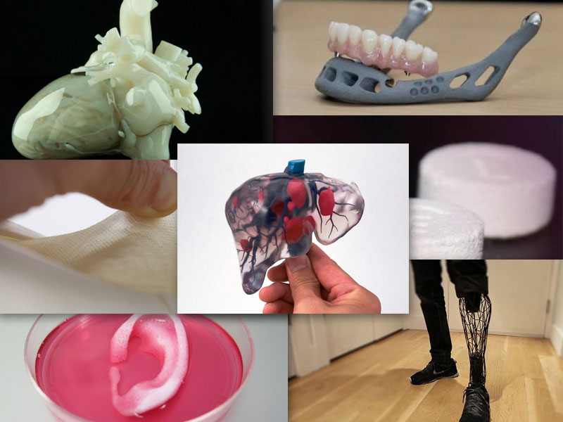Que es la impresión 3D en la salud y que utilidad tiene en el futuro